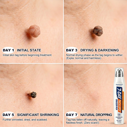𝐏𝐡𝐚𝐫𝐦𝐚𝐜𝐢𝐬𝐭 𝐑𝐞𝐜𝐨𝐦𝐦𝐞𝐧𝐝𝐞𝐝 🌿🌿Natravor® 7-𝐷𝑎𝑦 𝗧𝐚𝐠 & 𝗦𝗽𝐨𝐭 𝐄𝐫𝒂𝒔𝒆𝒓🪄(Zero 𝐏𝐚𝐢𝐧, Zero 𝐒𝐜𝐚𝒓𝒔 Rollerball)👩‍⚕️